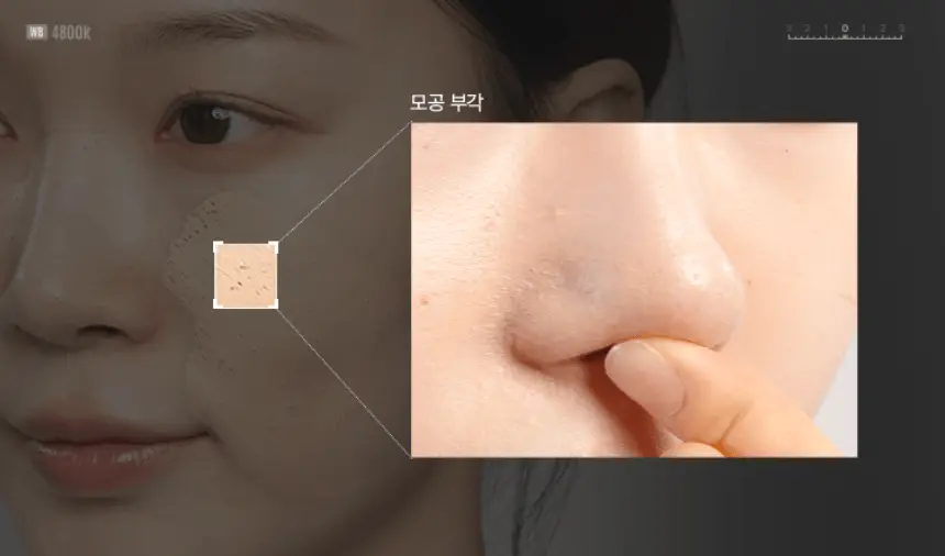 [모공수축] 셀올로지 포어샷 MTS (MTS/앰플/카트리지) 상세페이지 24